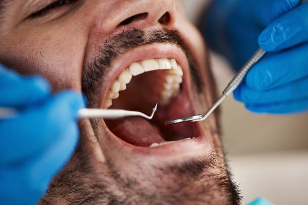 Best Root Canal Treatment  in Mount Clemens, MI